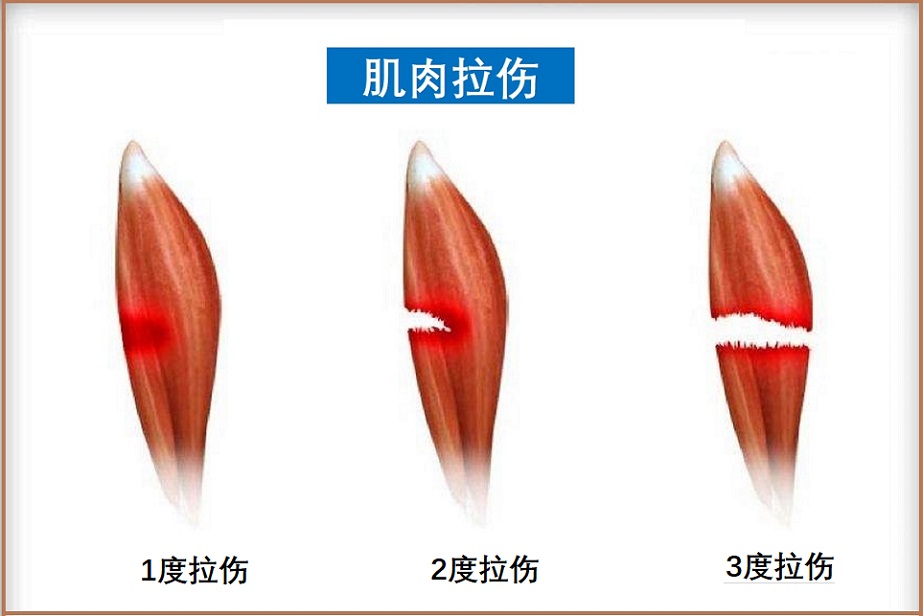 王昶