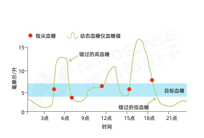 管理