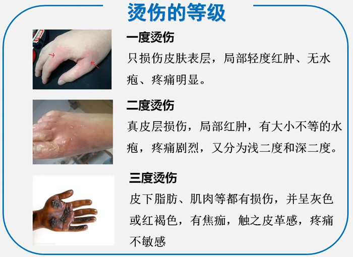 街头小吃的意外诞生