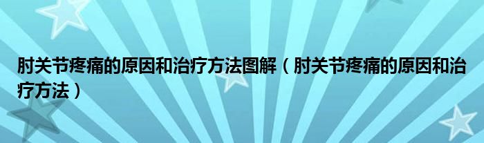 杰克