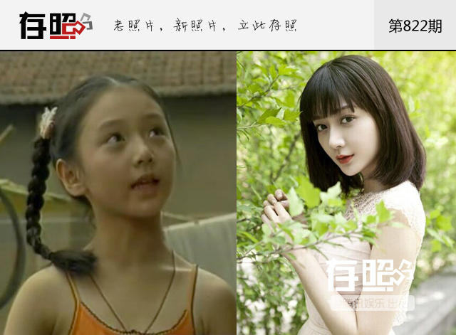 剖宫产