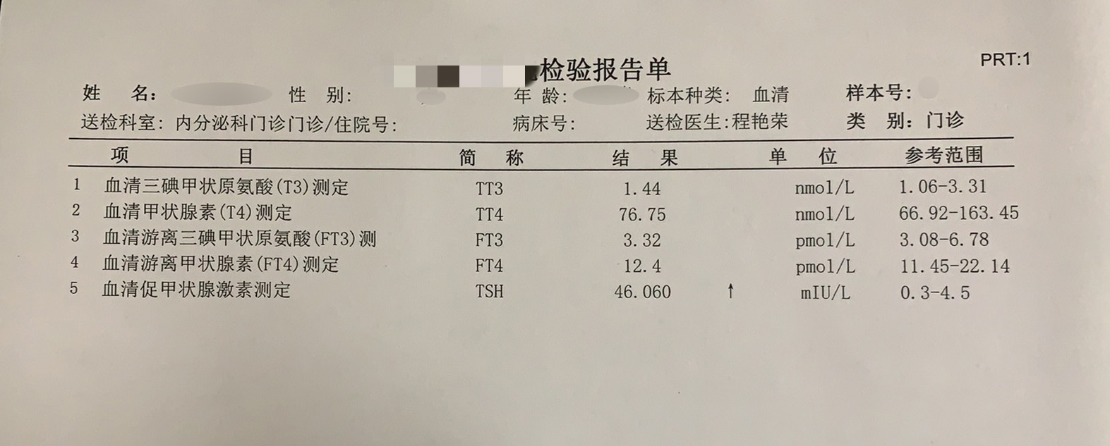 甲型