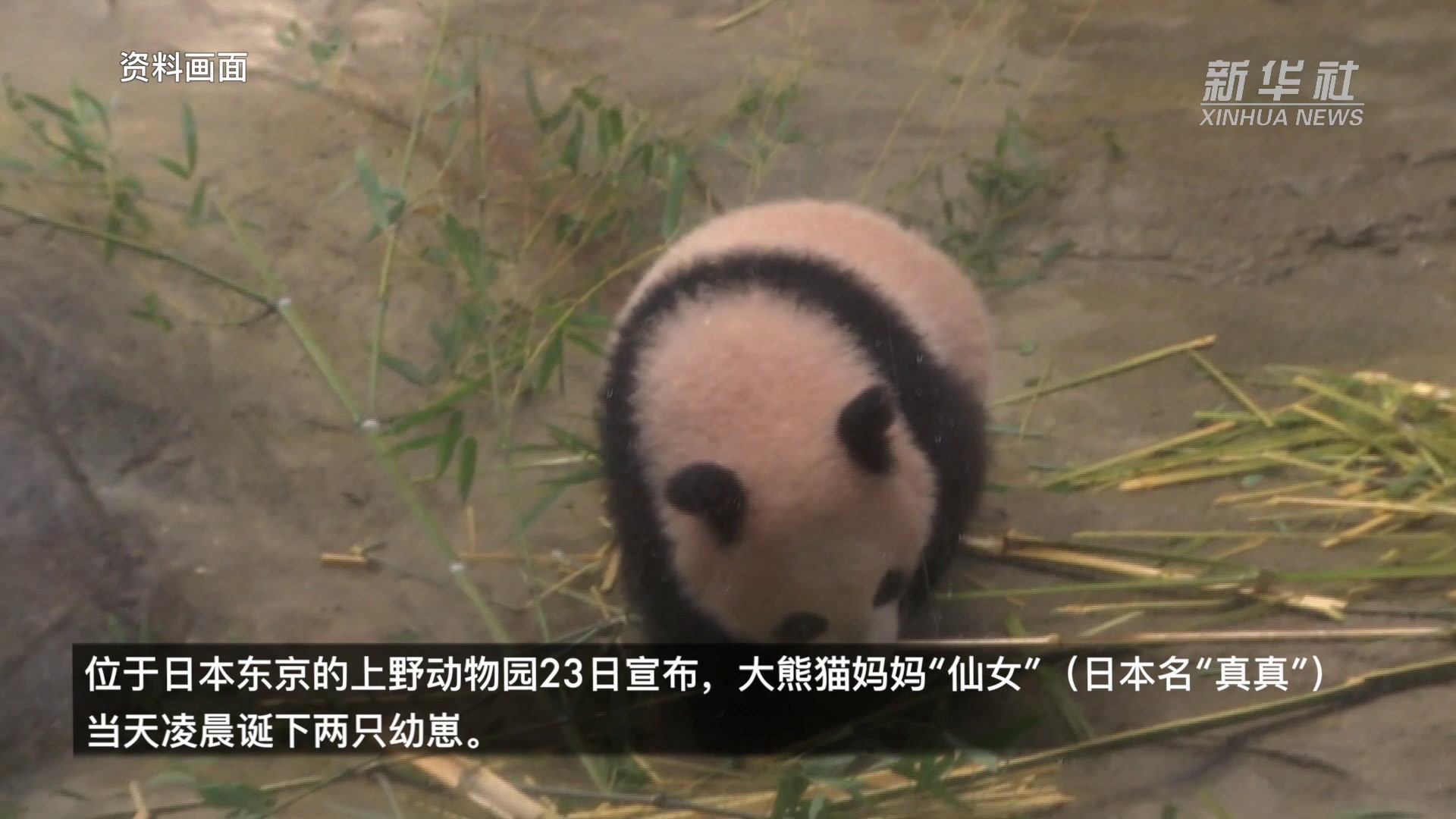 直肠癌